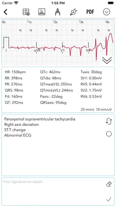 PMcardio for Individuals app screenshot 4
