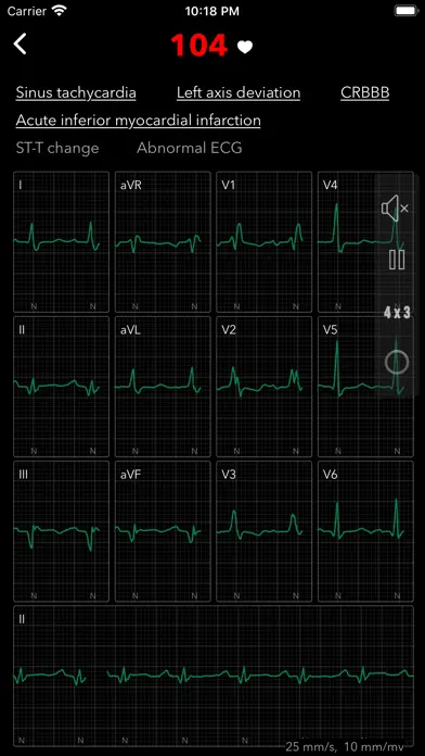 PMcardio for Individuals app screenshot 6